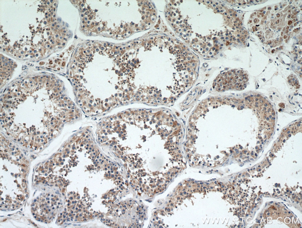 Immunohistochemistry (IHC) staining of human testis tissue using FLJ23584 Polyclonal antibody (21143-1-AP)