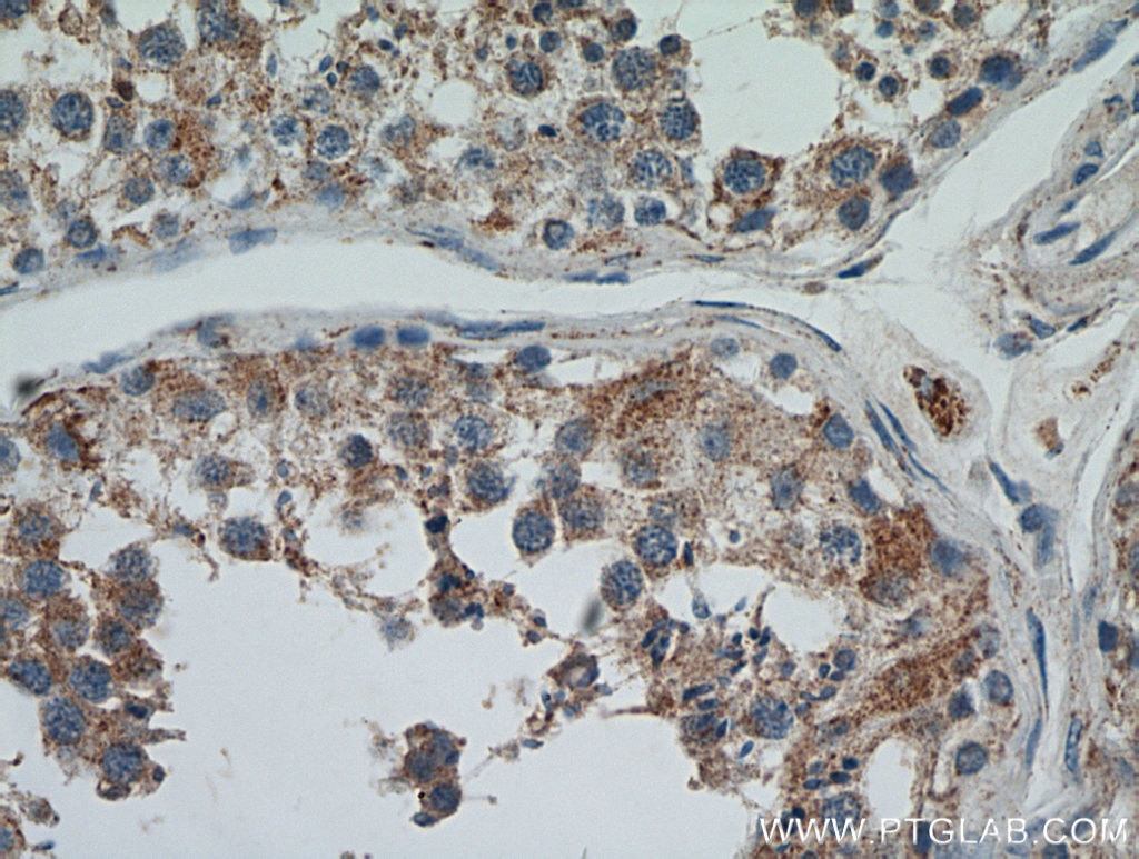 Immunohistochemistry (IHC) staining of human testis tissue using FLJ23584 Polyclonal antibody (21143-1-AP)