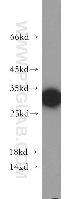 Western Blot (WB) analysis of HepG2 cells using FLJ23584 Polyclonal antibody (21143-1-AP)