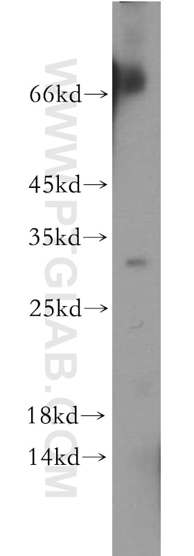 Western Blot (WB) analysis of human brain tissue using FLJ23584 Polyclonal antibody (21143-1-AP)