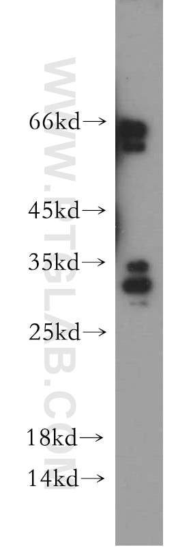 Western Blot (WB) analysis of mouse liver tissue using FLJ23584 Polyclonal antibody (21143-1-AP)
