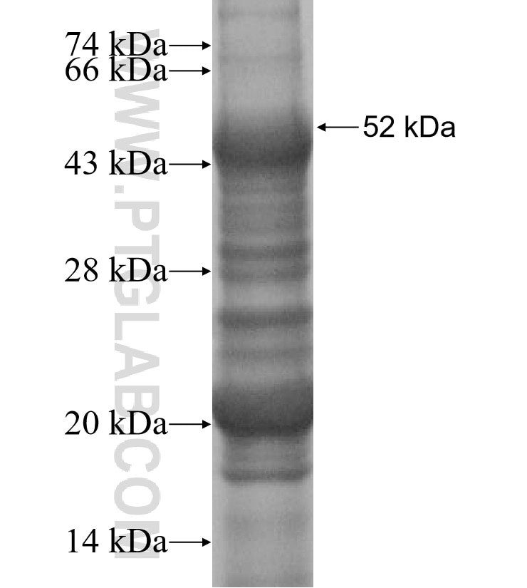 CTA-216E10.6 fusion protein Ag15647 SDS-PAGE