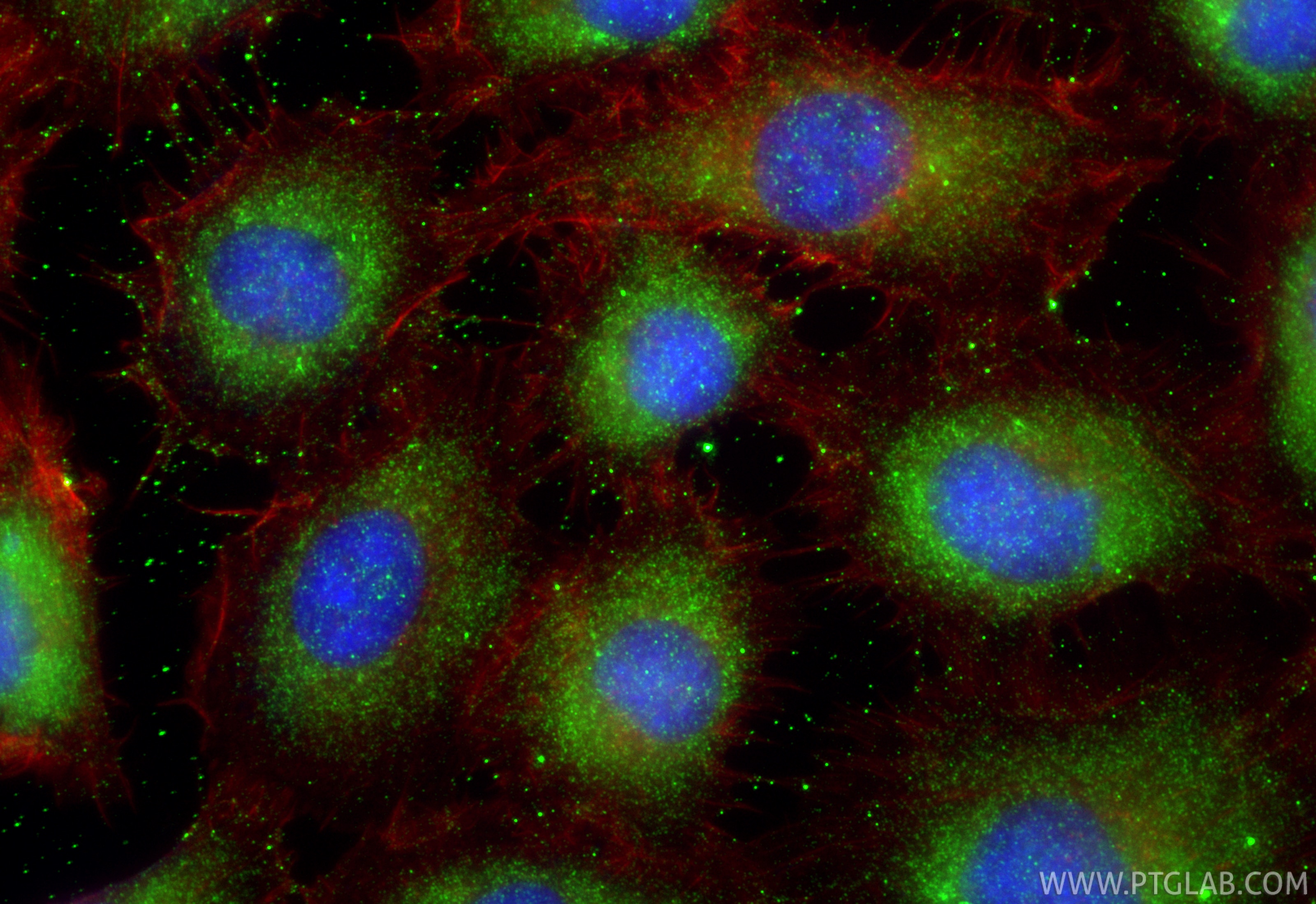 Immunofluorescence (IF) / fluorescent staining of HT-1080 cells using NY-ESO-1 Polyclonal antibody (19521-1-AP)