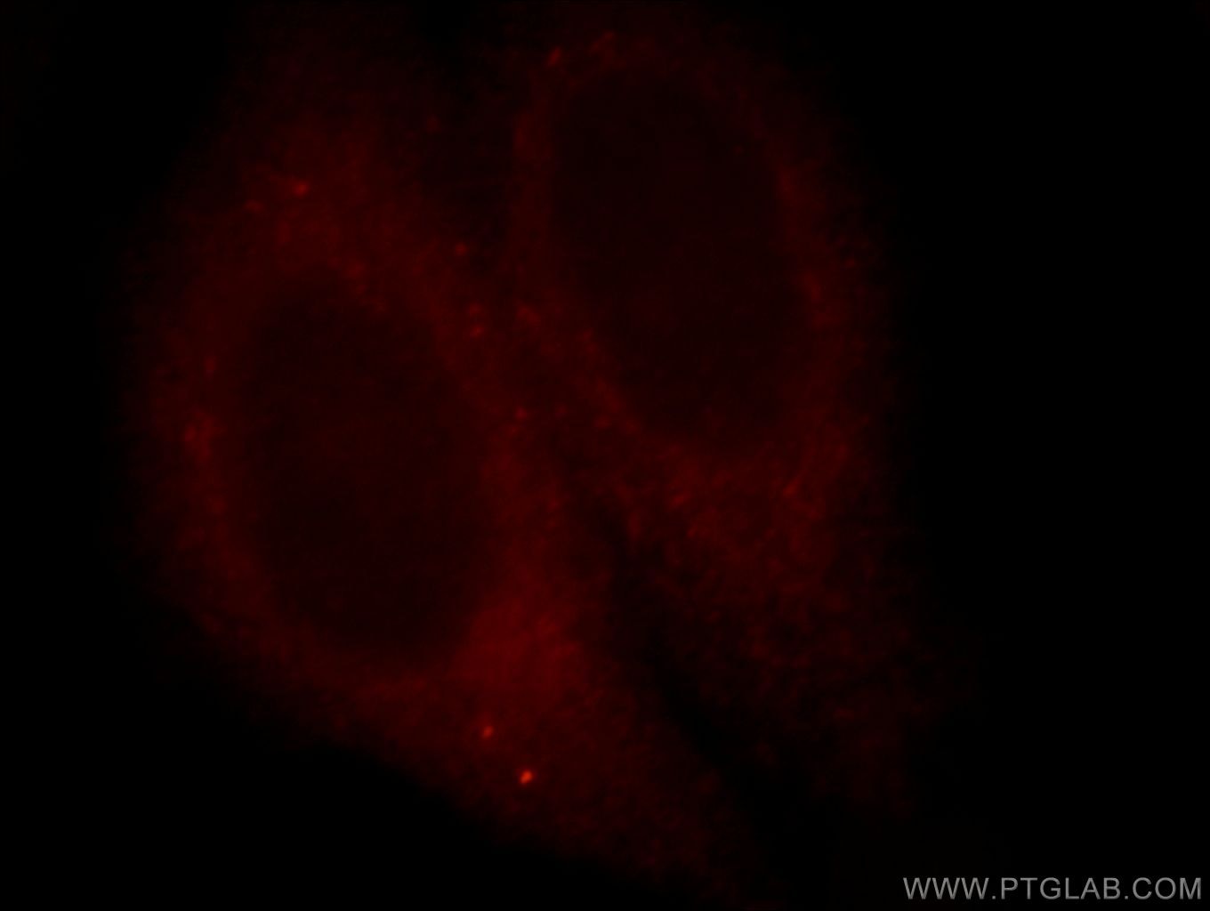 Immunofluorescence (IF) / fluorescent staining of HepG2 cells using NY-ESO-1 Polyclonal antibody (19521-1-AP)