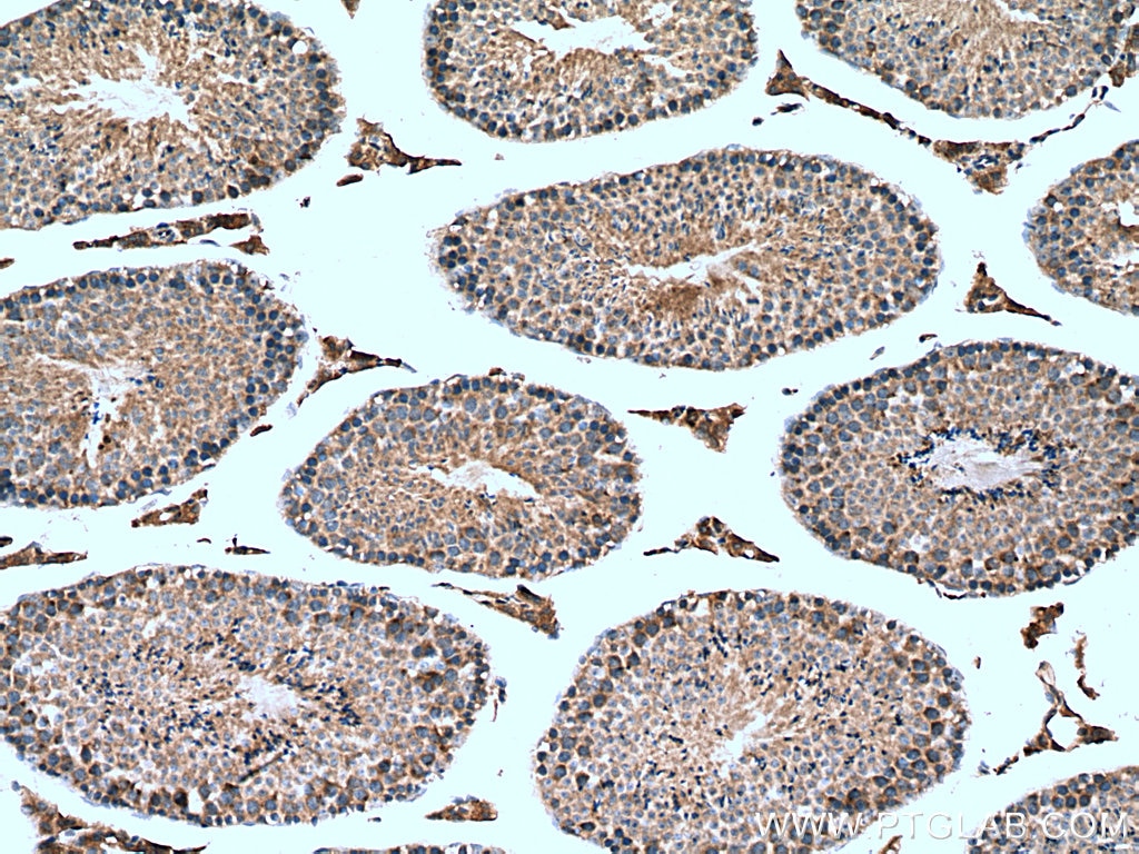 Immunohistochemistry (IHC) staining of mouse testis tissue using NY-ESO-1 Polyclonal antibody (19521-1-AP)
