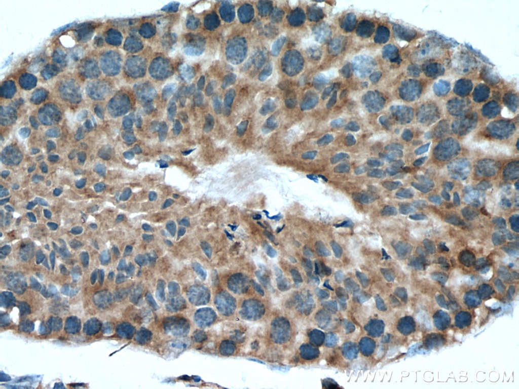 Immunohistochemistry (IHC) staining of mouse testis tissue using NY-ESO-1 Polyclonal antibody (19521-1-AP)