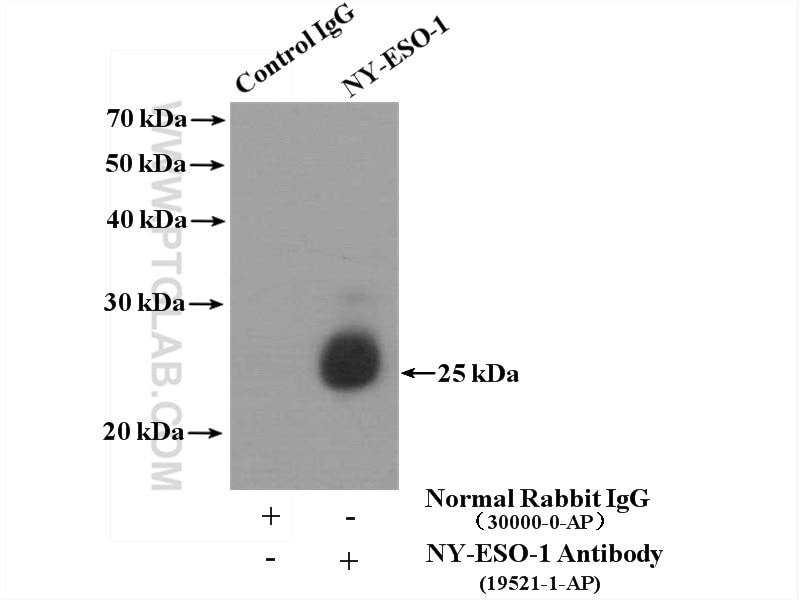Immunoprecipitation (IP) experiment of HepG2 cells using NY-ESO-1 Polyclonal antibody (19521-1-AP)