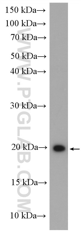 Western Blot (WB) analysis of HT-1080 cells using NY-ESO-1 Polyclonal antibody (19521-1-AP)