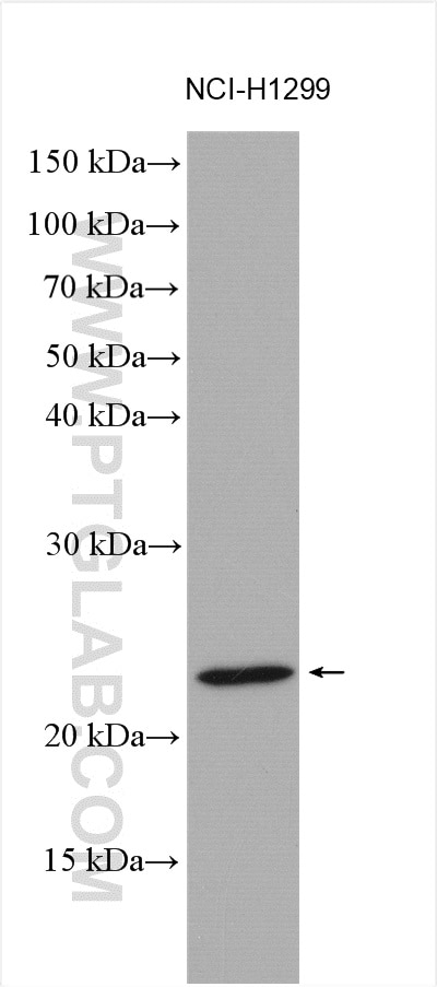 Western Blot (WB) analysis of various lysates using NY-ESO-1 Polyclonal antibody (19521-1-AP)