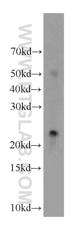 Western Blot (WB) analysis of human testis tissue using NY-ESO-1 Polyclonal antibody (19521-1-AP)