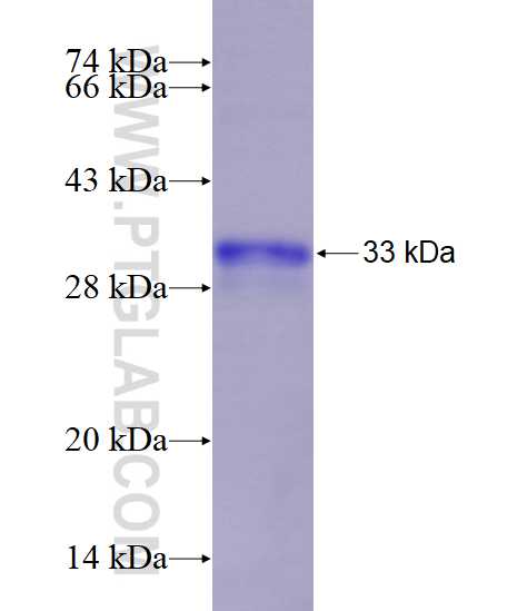 CTAG1B fusion protein Ag18784 SDS-PAGE