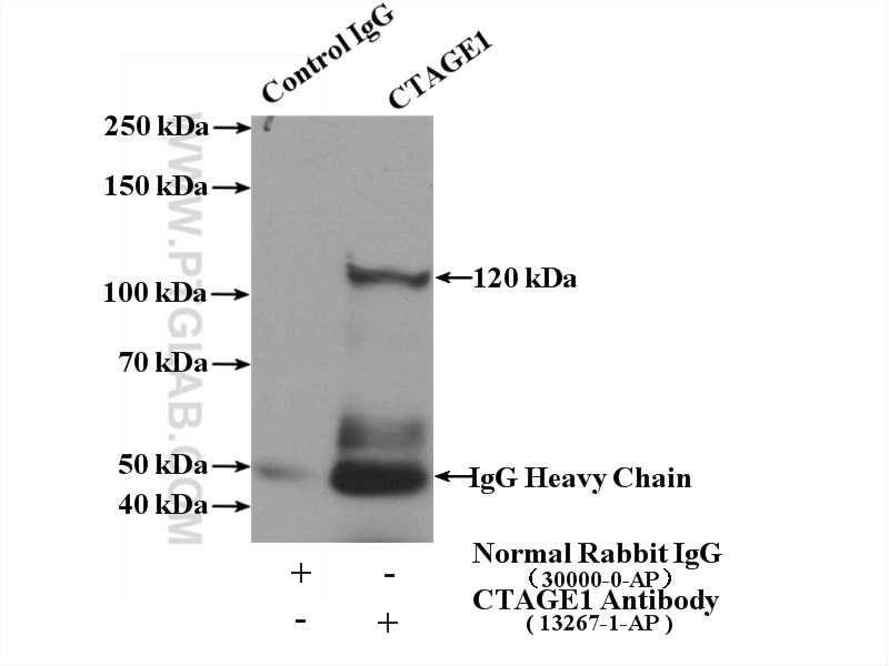 Immunoprecipitation (IP) experiment of HeLa cells using CTAGE1 Polyclonal antibody (13267-1-AP)