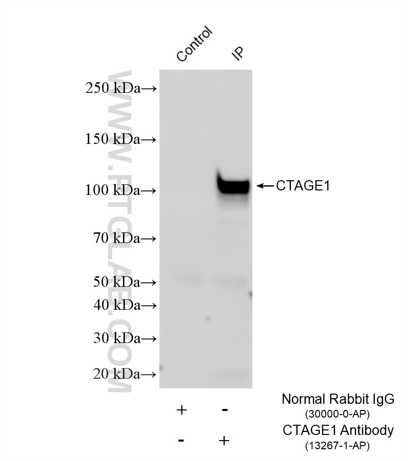 IP experiment of HeLa using 13267-1-AP Immunoprecipitation (IP) experiment of HeLa cells using CTAGE1 Polyclonal antibody (13267-1-AP)