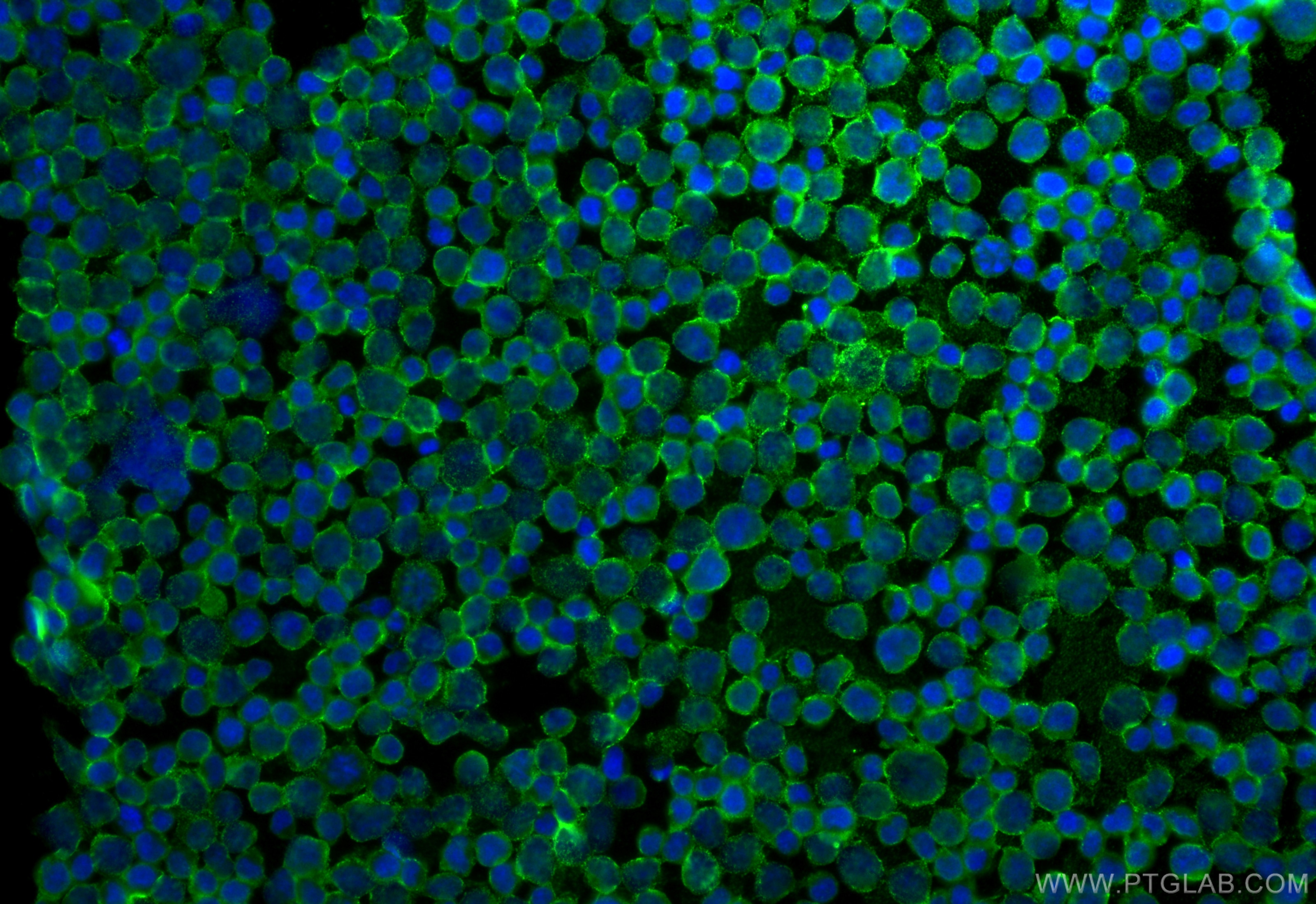Immunofluorescence (IF) / fluorescent staining of Jurkat cells using CTAGE1 Monoclonal antibody (60087-1-Ig)