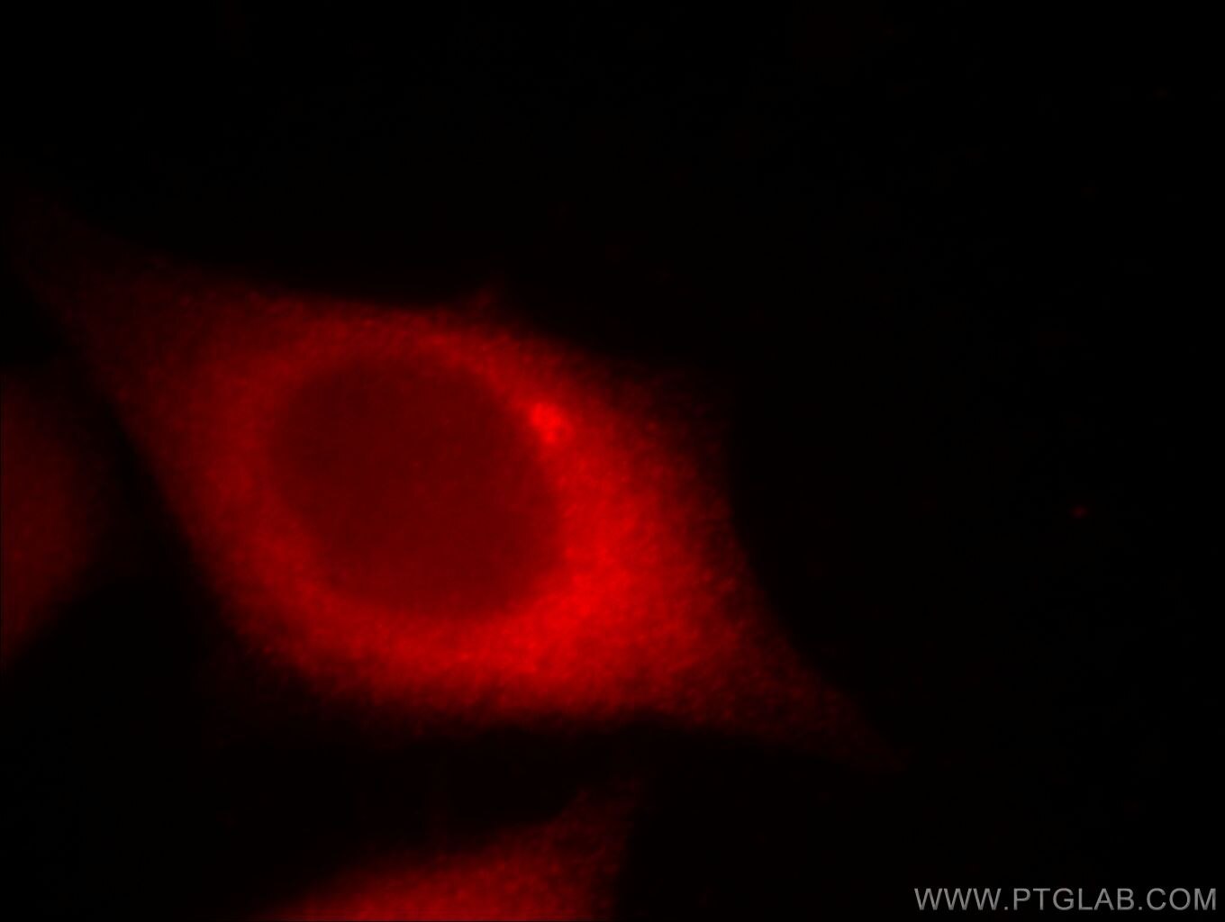 Immunofluorescence (IF) / fluorescent staining of MCF-7 cells using CTAGE1 Monoclonal antibody (60087-1-Ig)