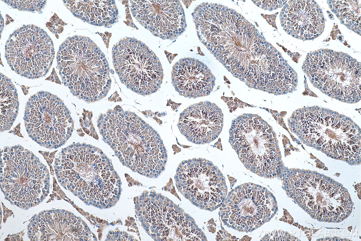 Immunohistochemistry (IHC) staining of mouse testis tissue using CTAGE1 Monoclonal antibody (60087-1-Ig)