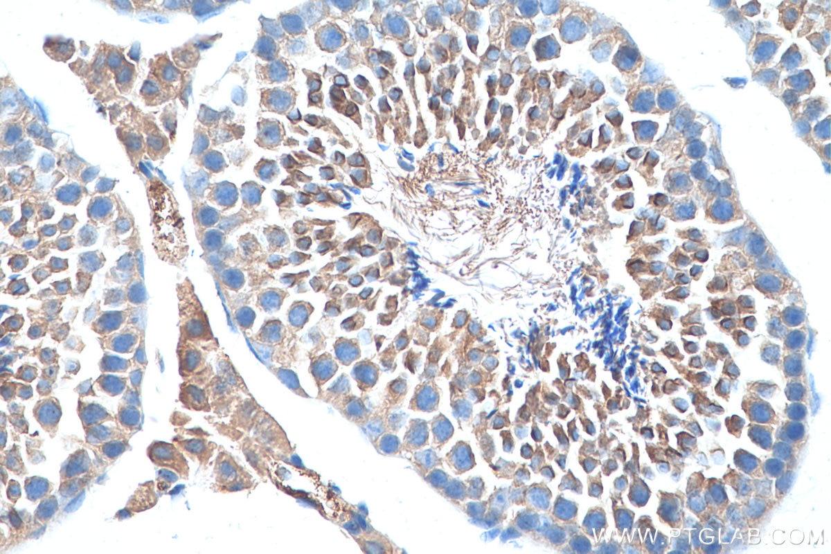 Immunohistochemistry (IHC) staining of mouse testis tissue using CTAGE1 Monoclonal antibody (60087-1-Ig)