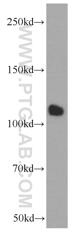 Western Blot (WB) analysis of HeLa cells using CTAGE1 Monoclonal antibody (60087-1-Ig)