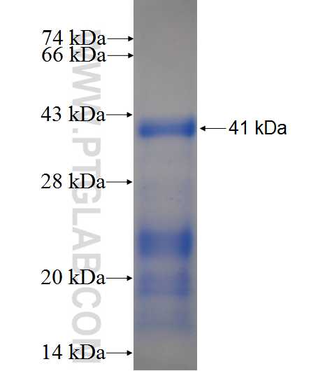 CTAGE1 fusion protein Ag3948 SDS-PAGE