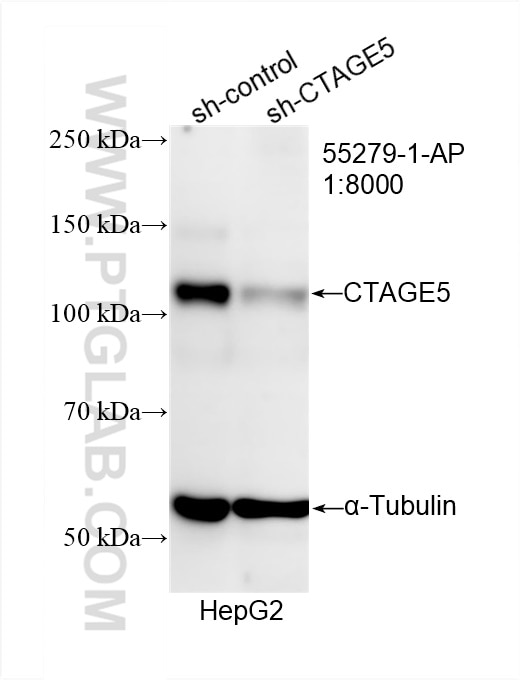 Western Blot (WB) analysis of HepG2 cells using CTAGE5 Polyclonal antibody (55279-1-AP)