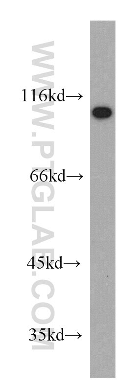 Western Blot (WB) analysis of human brain tissue using CTAGE5 Polyclonal antibody (55279-1-AP)