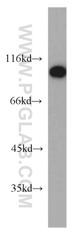 Western Blot (WB) analysis of human testis tissue using CTAGE5 Polyclonal antibody (55279-1-AP)