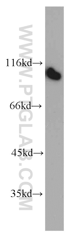 Western Blot (WB) analysis of human testis tissue using CTAGE5 Polyclonal antibody (55279-1-AP)