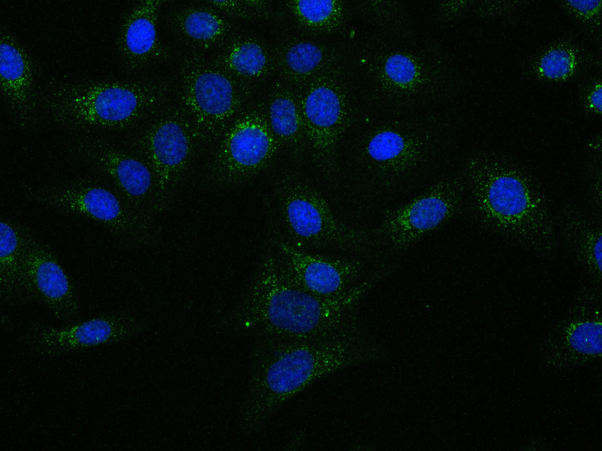 Immunofluorescence (IF) / fluorescent staining of HepG2 cells using CTAGE5 Recombinant antibody (83017-2-RR)