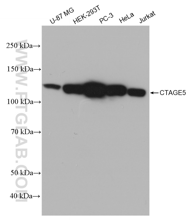 Western Blot (WB) analysis of various lysates using CTAGE5 Recombinant antibody (83017-2-RR)