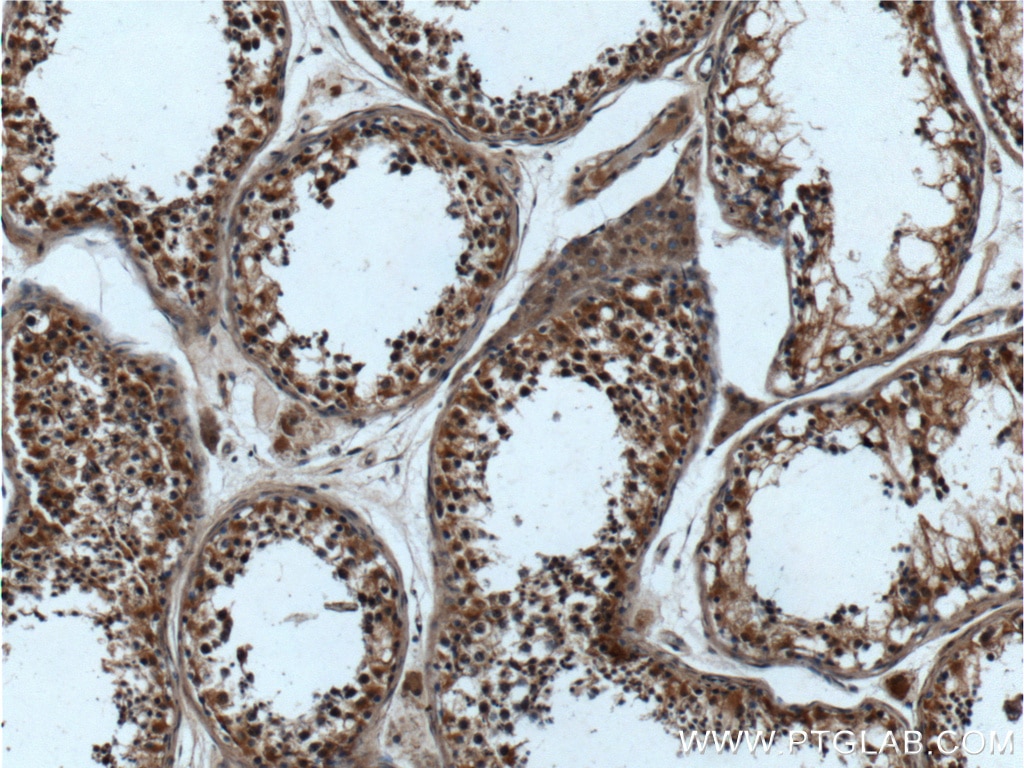 Immunohistochemistry (IHC) staining of human testis tissue using CTAGE6 Polyclonal antibody (17438-1-AP)