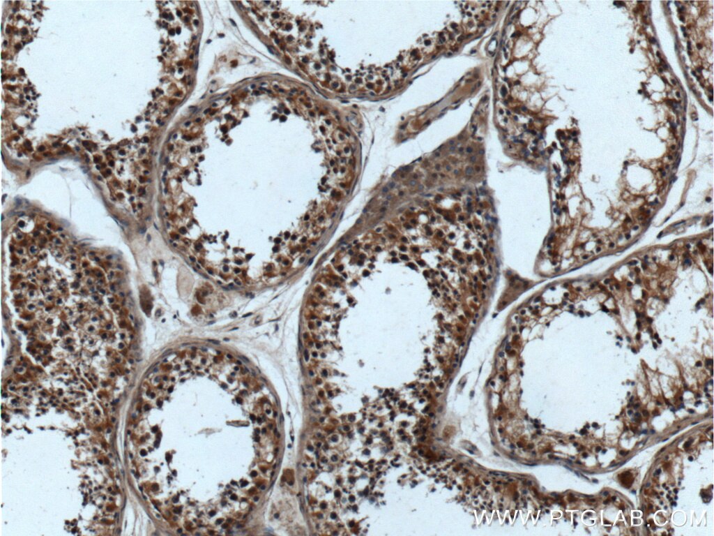 IHC staining of human testis using 17438-1-AP