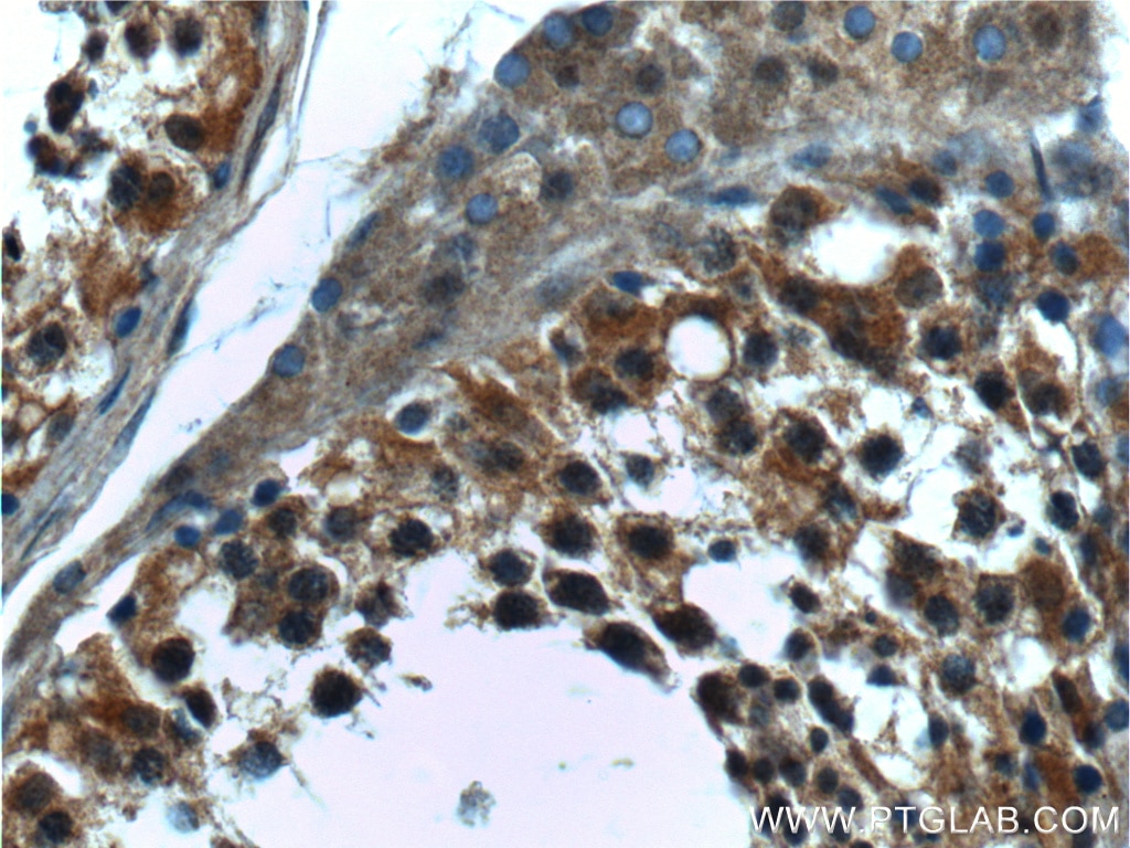Immunohistochemistry (IHC) staining of human testis tissue using CTAGE6 Polyclonal antibody (17438-1-AP)