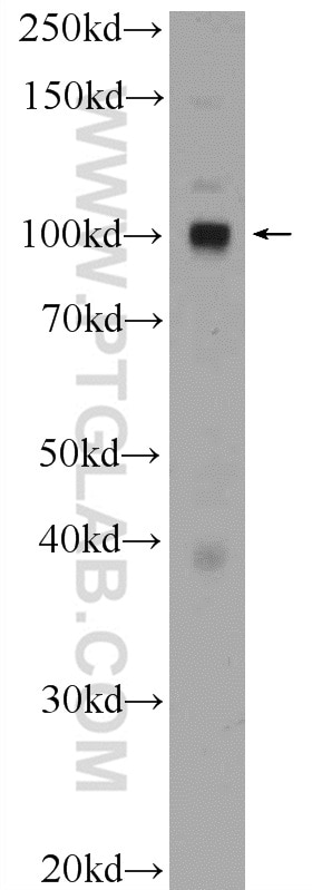 Western Blot (WB) analysis of HeLa cells using CTAGE6 Polyclonal antibody (17438-1-AP)