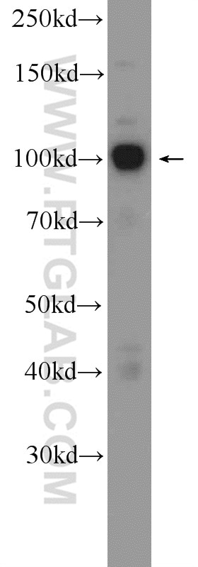 WB analysis of MCF-7 using 17438-1-AP