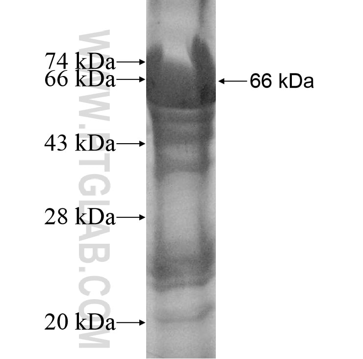 CTAGE6 fusion protein Ag11511 SDS-PAGE