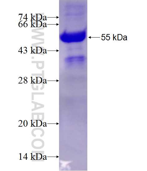 CTAGE6 fusion protein Ag11635 SDS-PAGE