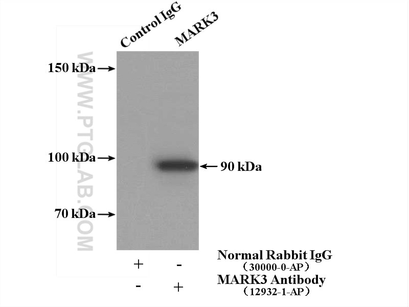 Immunoprecipitation (IP) experiment of mouse brain tissue using MARK3 Polyclonal antibody (12932-1-AP)