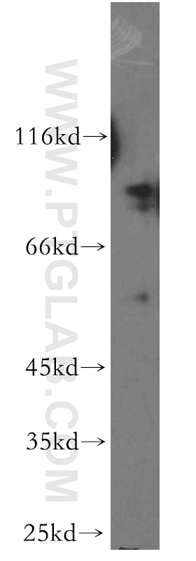 Western Blot (WB) analysis of human brain tissue using MARK3 Polyclonal antibody (12932-1-AP)