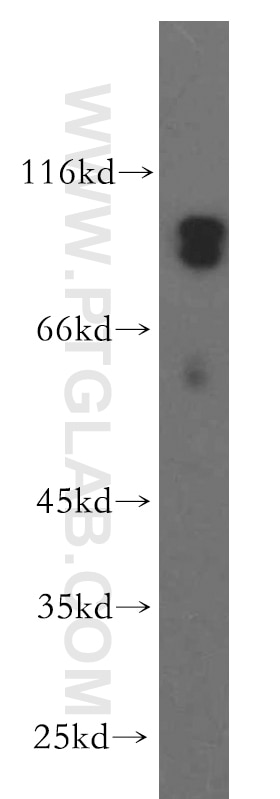 Western Blot (WB) analysis of human brain tissue using MARK3 Polyclonal antibody (12932-1-AP)