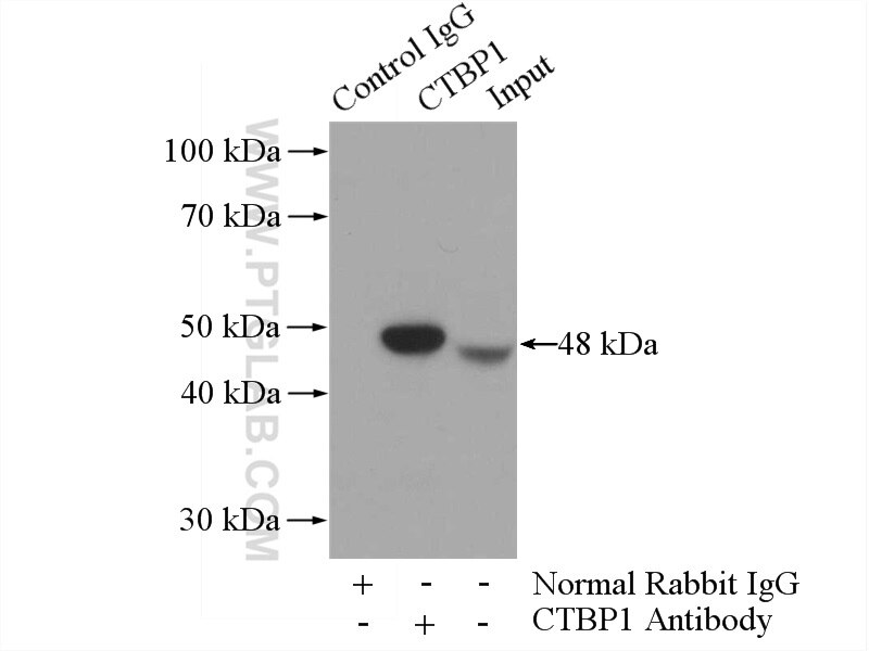 Immunoprecipitation (IP) experiment of mouse brain tissue using CTBP1 Polyclonal antibody (10972-1-AP)