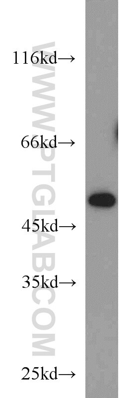 CTBP1 Polyclonal antibody