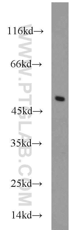 Western Blot (WB) analysis of mouse skeletal muscle tissue using CTBP1 Polyclonal antibody (10972-1-AP)