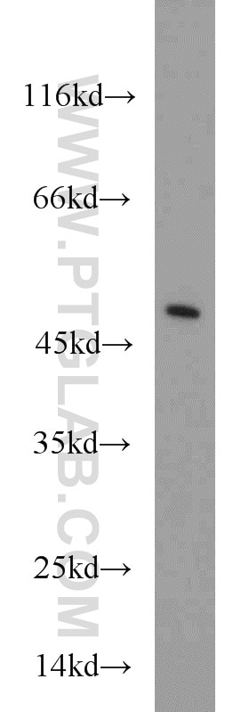 Western Blot (WB) analysis of mouse thymus tissue using CTBP1 Polyclonal antibody (10972-1-AP)