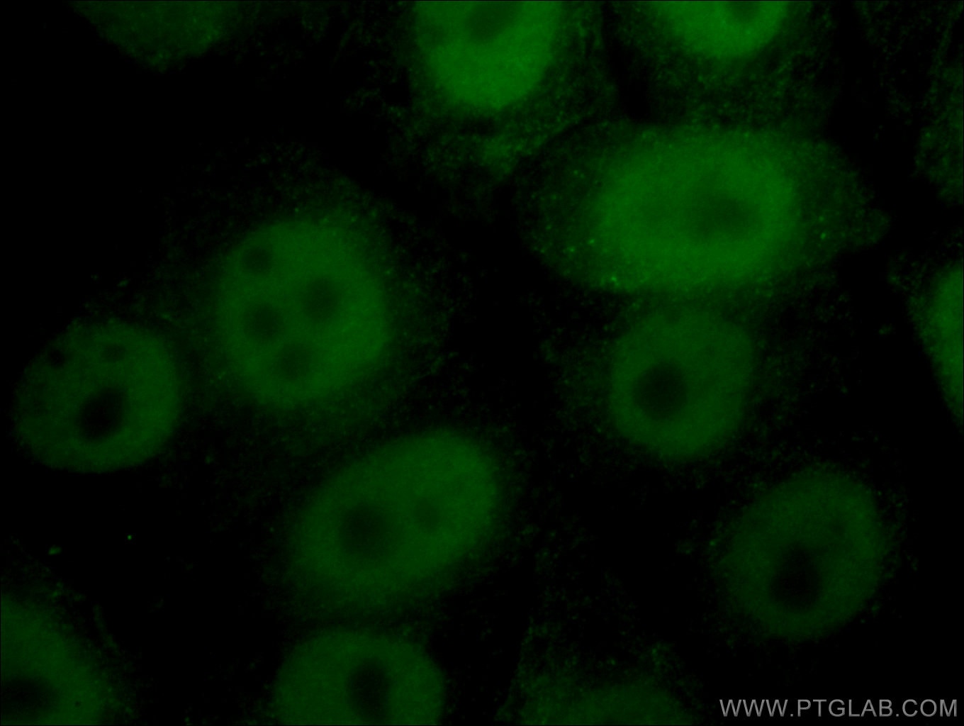 Immunofluorescence (IF) / fluorescent staining of HepG2 cells using CTBP1 Monoclonal antibody (66995-1-Ig)