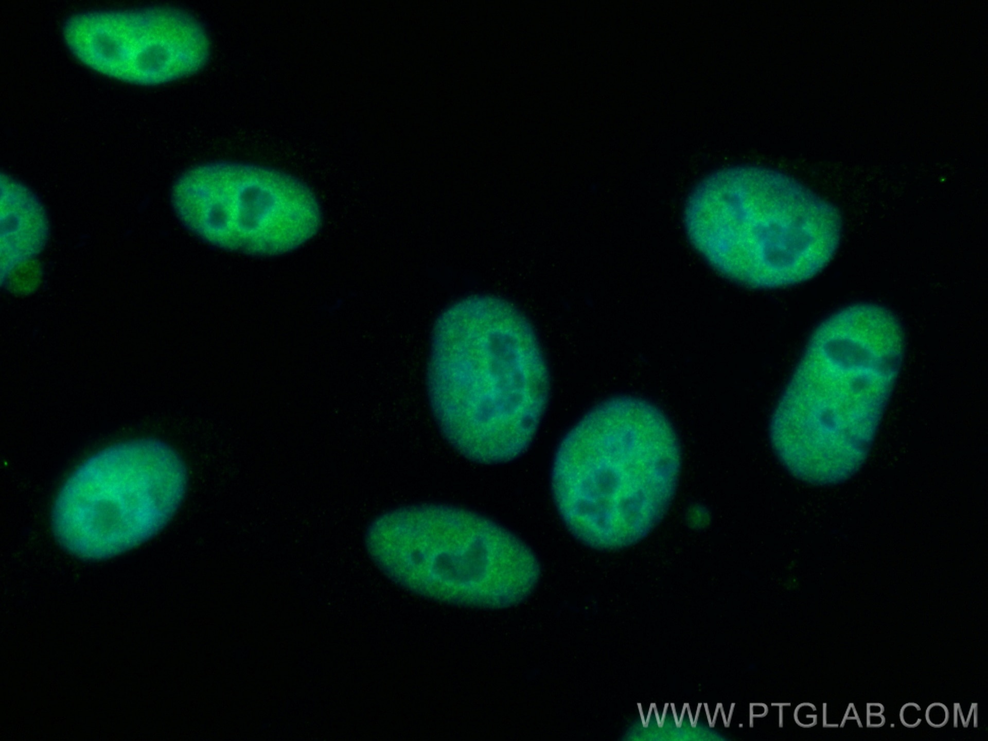Immunofluorescence (IF) / fluorescent staining of HepG2 cells using CTBP1 Monoclonal antibody (66995-1-Ig)
