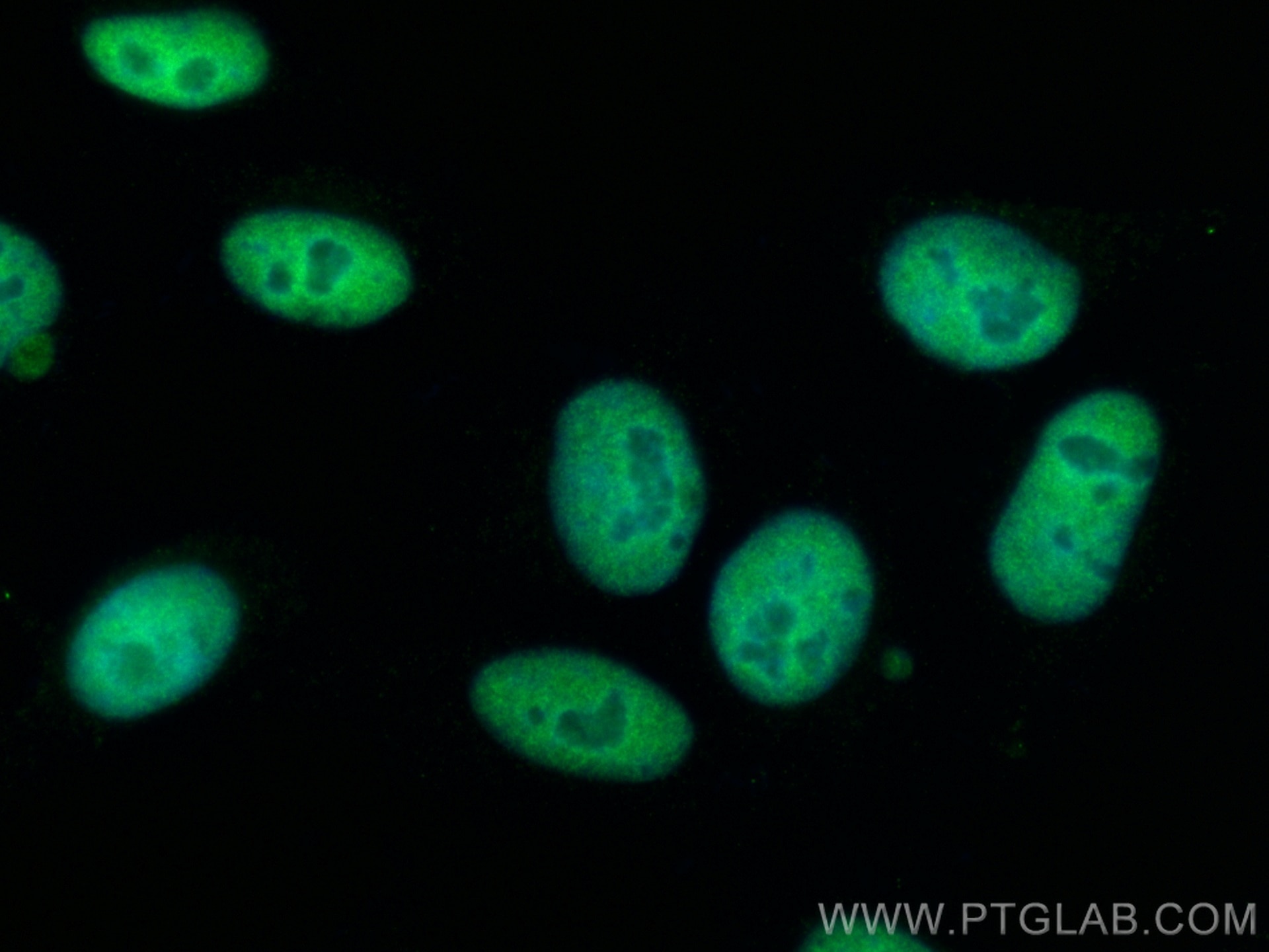 IF Staining of HepG2 using 66995-1-Ig