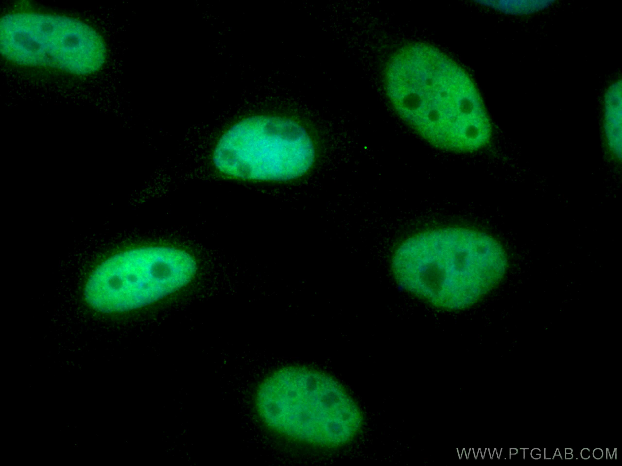 Immunofluorescence (IF) / fluorescent staining of HeLa cells using CTBP1 Monoclonal antibody (66995-1-Ig)