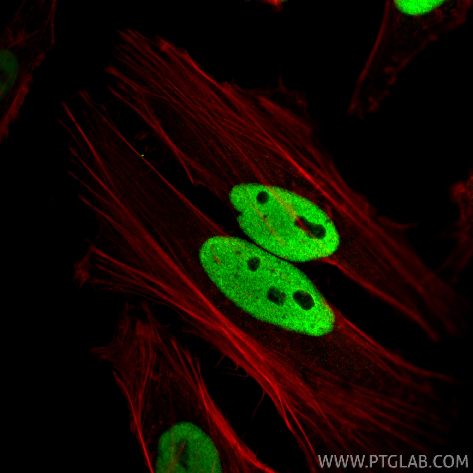 IF Staining of HeLa using 66995-1-Ig Immunofluorescence (IF) / fluorescent staining of HeLa cells using CTBP1 Monoclonal antibody (66995-1-Ig)