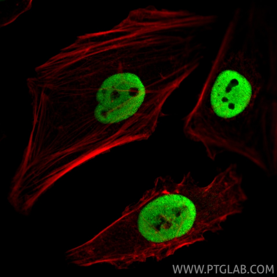 IF Staining of HeLa using CL488-66995 Immunofluorescence (IF) / fluorescent staining of HeLa cells using CoraLite® Plus 488-conjugated CTBP1 Monoclonal ant (CL488-66995)