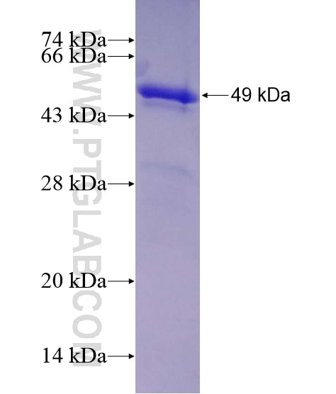 CTBP1 fusion protein Ag28567 SDS-PAGE